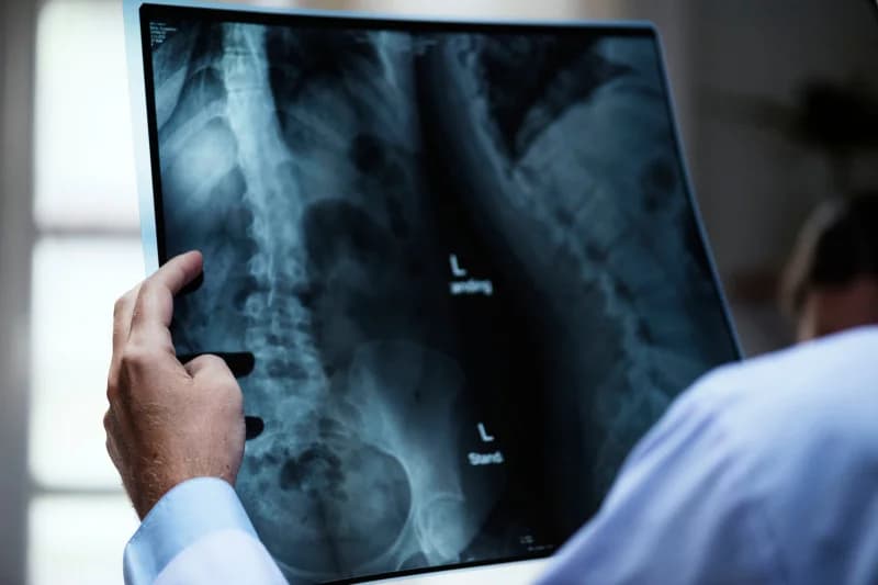 Can Medical Bills Affect My Credit?